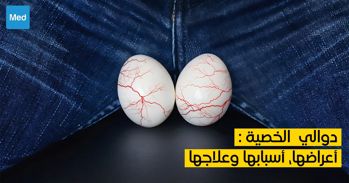 دوالي الخصية : أعراضها، أسبابها وعلاجها